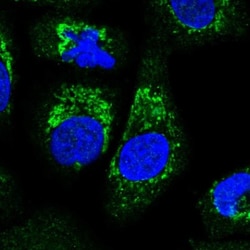 ALDH16A1 Antibody, Novus Biologicals 25 &mu;L, Unlabeled:Antibodies, Polyclonal